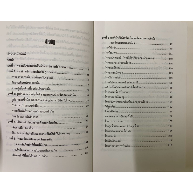 รู้โรคร้ายด้วยลายมือ โดย ดานนท์ หัตถศาสตร์การแพทย์ รูปที่ 3