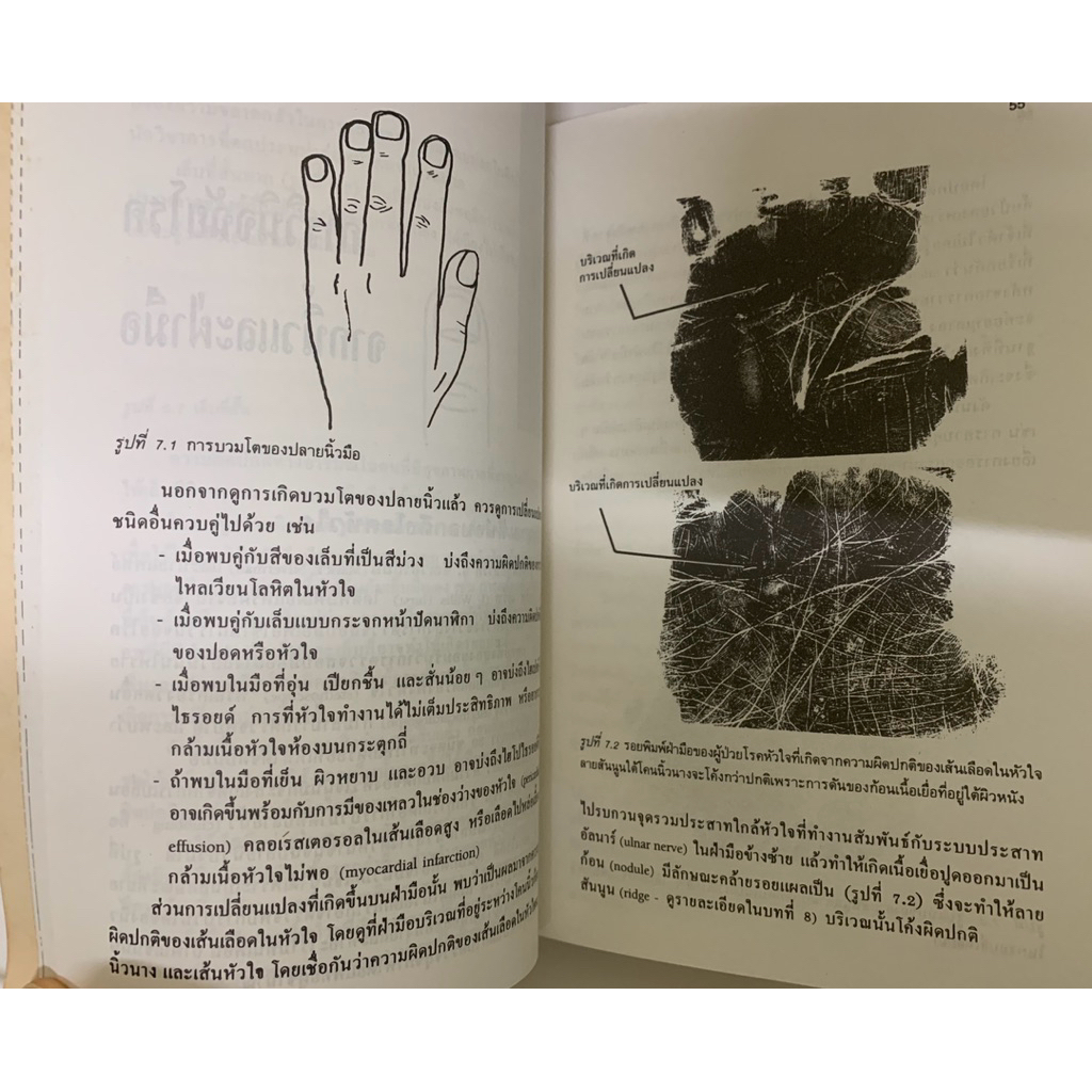 วิเคราะห์มือสื่อสุขภาพ ยูจีน ไชมันน์ *ลายมือ รูปที่ 8